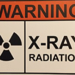 xray